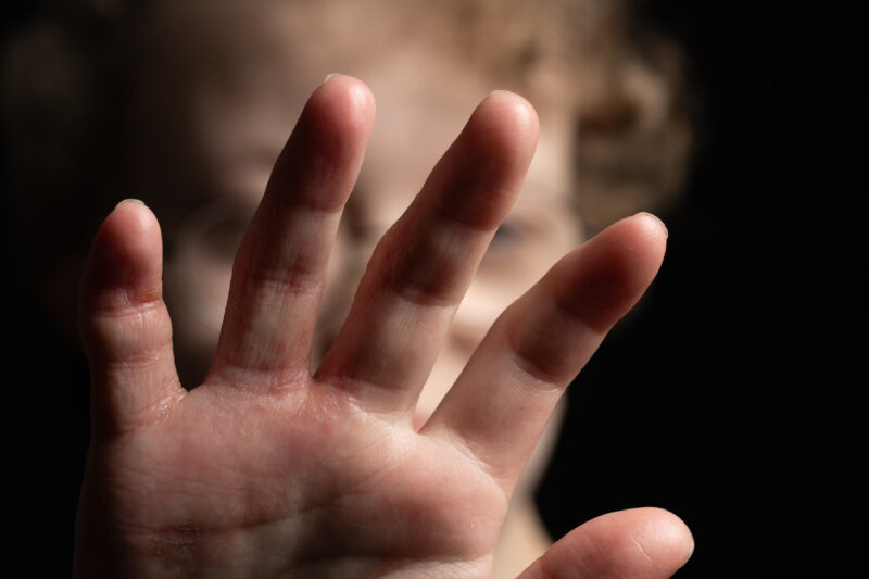 Hand covering face.